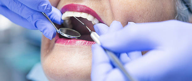 Best Emergency Dentist for Knocked-Out Tooth in Fairport, NY